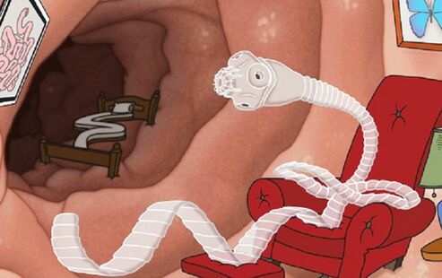 A parasite settled in the intestine